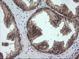 IHC of paraffin-embedded Human prostate tissue using anti-OTUB1 mouse monoclonal antibody.