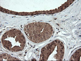 IHC of paraffin-embedded Human breast tissue using anti-OTUB1 mouse monoclonal antibody.