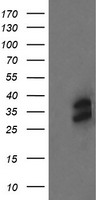 HEK293T cells were transfected with the pCMV6-ENTRY control (Left lane) or pCMV6-ENTRY OTUB1 (Right lane) cDNA for 48 hrs and lysed. Equivalent amounts of cell lysates (5 ug per lane) were separated by SDS-PAGE and immunoblotted with anti-OTUB1.