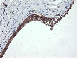 IHC of paraffin-embedded Human bladder tissue using anti-OTUB1 mouse monoclonal antibody.