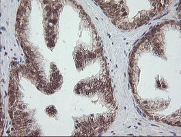 IHC of paraffin-embedded Human prostate tissue using anti-OTUB1 mouse monoclonal antibody.