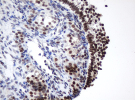 IHC of paraffin-embedded Human Ovary tissue using anti-METT10D mouse monoclonal antibody.