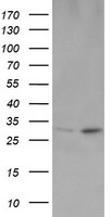 HEK293T cells were transfected with the pCMV6-ENTRY control (Left lane) or pCMV6-ENTRY OTUB1 (Right lane) cDNA for 48 hrs and lysed. Equivalent amounts of cell lysates (5 ug per lane) were separated by SDS-PAGE and immunoblotted with anti-OTUB1.