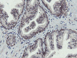 IHC of paraffin-embedded Human prostate tissue using anti-OTUB1 mouse monoclonal antibody.