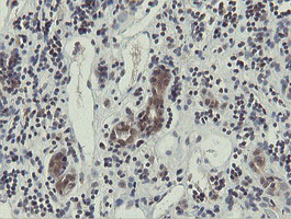 IHC of paraffin-embedded Carcinoma of Human kidney tissue using anti-OTUB1 mouse monoclonal antibody.