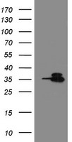 HEK293T cells were transfected with the pCMV6-ENTRY control (Left lane) or pCMV6-ENTRY OTUB1 (Right lane) cDNA for 48 hrs and lysed. Equivalent amounts of cell lysates (5 ug per lane) were separated by SDS-PAGE and immunoblotted with anti-OTUB1.