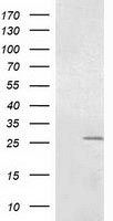 HEK293T cells were transfected with the pCMV6-ENTRY control (Left lane) or pCMV6-ENTRY OTUB2 (Right lane) cDNA for 48 hrs and lysed. Equivalent amounts of cell lysates (5 ug per lane) were separated by SDS-PAGE and immunoblotted with anti-OTUB2.