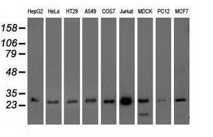Western blot of extracts (35 ug) from 9 different cell lines by using anti-OTUB2 monoclonal antibody.