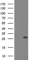 HEK293T cells were transfected with the pCMV6-ENTRY control (Left lane) or pCMV6-ENTRY OTUB2 (Right lane) cDNA for 48 hrs and lysed. Equivalent amounts of cell lysates (5 ug per lane) were separated by SDS-PAGE and immunoblotted with anti-OTUB2.