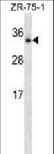 OTUB2 Antibody western blot of ZR-75-1 cell line lysates (35 ug/lane). The OTUB2 antibody detected the OTUB2 protein (arrow).