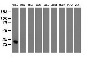 Western blot of extracts (35 ug) from 9 different cell lines by using anti-OTUB2 monoclonal antibody.