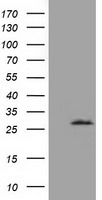 HEK293T cells were transfected with the pCMV6-ENTRY control (Left lane) or pCMV6-ENTRY OTUB2 (Right lane) cDNA for 48 hrs and lysed. Equivalent amounts of cell lysates (5 ug per lane) were separated by SDS-PAGE and immunoblotted with anti-OTUB2.
