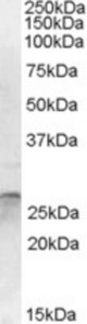 Antibody (1 ug/ml) staining of Human Cerebellum lysate (35 ug protein in RIPA buffer). Primary incubation was 1 hour. Detected by chemiluminescence