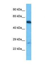 Western blot of Human HepG2. OTUD1 antibody dilution 1.0 ug/ml.