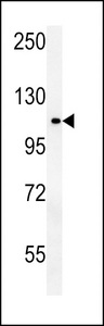 OTUD4 Antibody western blot of MDA-MB435 cell line lysates (35 ug/lane). The OTUD4 antibody detected the OTUD4 protein (arrow).