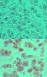 IHC of DUBA in formalin-fixed, paraffin-embedded human liver tissue using an isotype control (top) and LS-C148579 (bottom) at 5 ug/ml.