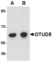 Western blot of OTUD5 in human kidney lysate with OTUD5 antibody at (A) 1 and (B) 2 ug/ml.
