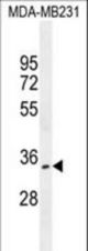OTUD6A Antibody western blot of MDA-MB231 cell line lysates (35 ug/lane). The OTUD6A antibody detected the OTUD6A protein (arrow).