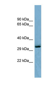OTUD6B antibody LS-C107864 Western blot of 293T cell lysate.