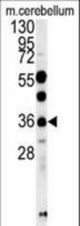 OTUD6B Antibody western blot of mouse cerebellum tissue lysates (15 ug/lane). The OTUD6B antibody detected OTUD6B protein (arrow).