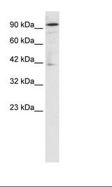 Daudi Cell Lysate
