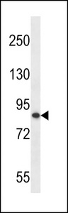 OTU7B Antibody western blot of MDA-MB453 cell line lysates (35 ug/lane). The OTU7B antibody detected the OTU7B protein (arrow).