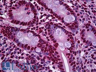 Anti-OTUD7B antibody IHC of human small intestine. Immunohistochemistry of formalin-fixed, paraffin-embedded tissue after heat-induced antigen retrieval. Antibody LS-B6034 concentration 5 ug/ml.