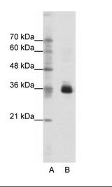 A: Marker, B: Jurkat Cell Lysate