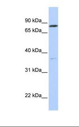 721_B cell lysate. Antibody concentration: 1.0 ug/ml. Gel concentration: 12%.