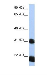 HepG2 cell lysate. Antibody concentration: 1.0 ug/ml. Gel concentration: 12%.