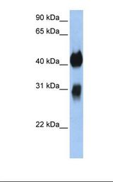 Transfected 293T cell lysate. Antibody concentration: 1.0 ug/ml. Gel concentration: 12%.