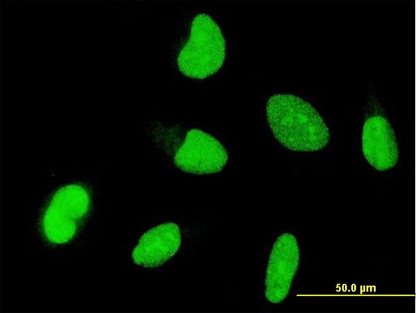 Immunofluorescence of monoclonal antibody to OTX1 on HeLa cell . [antibody concentration 10 ug/ml]