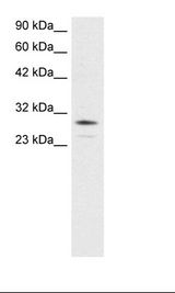 Jurkat Cell Lysate