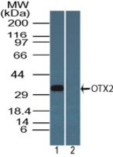 Western blot of OTX2 in Y79 cell lysate in the 1) absence and 2) presence of immunizing peptide using LS-C148664 at 1 ug/ml. Goat anti-rabbit Ig HRP secondary antibody, and PicoTect ECL substrate solution, were used for this test.
