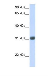 Fetal muscle lysate. Antibody concentration: 1.0 ug/ml. Gel concentration: 12%.