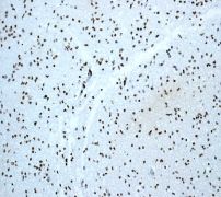 IHC of paraffin-embedded human fetal brain tissue using anti-OTX2 antibody (LS-C105730).