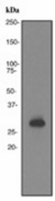 Western blot analysis on Y79 cell lysate using anti-OTX2 antibody (LS-C105730).
