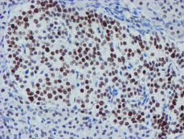 IHC of paraffin-embedded Human pancreas tissue using anti-METT10D mouse monoclonal antibody. (Heat-induced epitope retrieval by 10mM citric buffer, pH6.0, 100C for 10min).