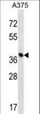 DPH1 Antibody western blot of A375 cell line lysates (35 ug/lane). The DPH1 antibody detected the DPH1 protein (arrow).