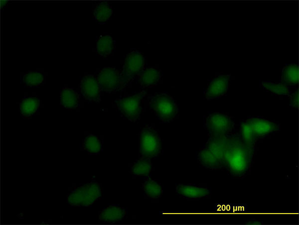Immunofluorescence of monoclonal antibody to DPH1 on HeLa cell. [antibody concentration 10 ug/ml]