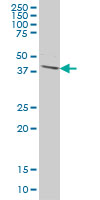 DPH1 monoclonal antibody (M02), clone 2C5 Western Blot analysis of DPH1 expression in HeLa.