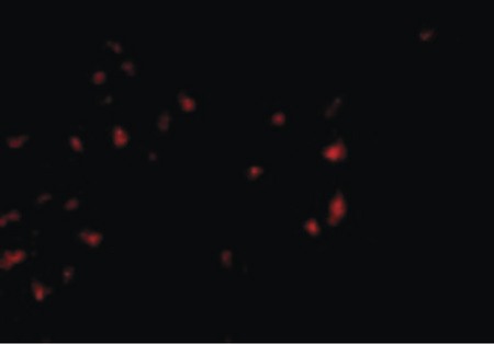 Immunofluorescence of OVGP1 in 293 cells with OVGP1 antibody at 2.5 ug/ml.