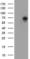HEK293T cells were transfected with the pCMV6-ENTRY control (Left lane) or pCMV6-ENTRY METT10D (Right lane) cDNA for 48 hrs and lysed. Equivalent amounts of cell lysates (5 ug per lane) were separated by SDS-PAGE and immunoblotted with anti-METT10D.