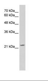 Jurkat Cell Lysate