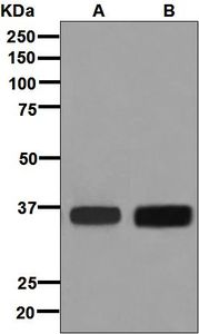 Western blot analysis on (A) NIH:OVCAR-3 and (B) JAR cell lysates using anti-OVOL2 antibody.