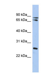 OVOL2 antibody LS-C109754 Western blot of HT1080 cell lysate.
