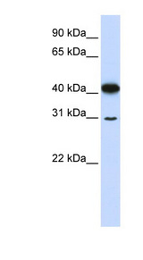OVOL2 antibody LS-C110394 Western blot of 721_B cell lysate.
