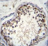 OVOS Antibody immunohistochemistry of formalin-fixed and paraffin-embedded human testis tissue followed by peroxidase-conjugated secondary antibody and DAB staining.