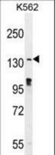OVOS Antibody western blot of K562 cell line lysates (35 ug/lane). The OVOS antibody detected the OVOS protein (arrow).