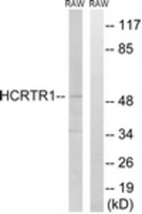 Western blot of extracts from RAW264.7 cells, using HCRTR1 Antibody. The lane on the right is treated with the synthesized peptide.